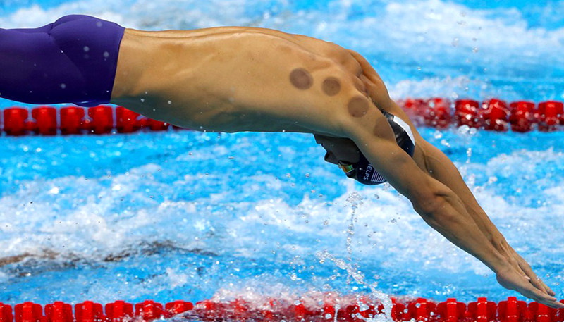 拔火罐有助于肌肉恢复吗,拔火罐能促进身体恢复吗