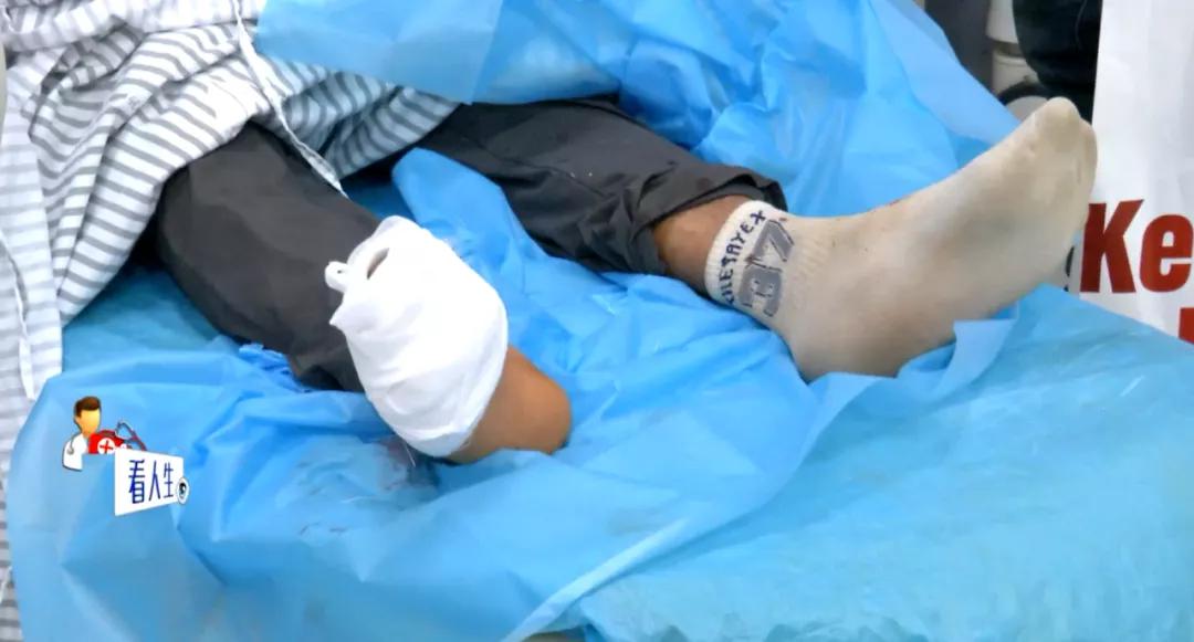 切割机切到手指要打破伤风吗,手指被切割机切断了还能接