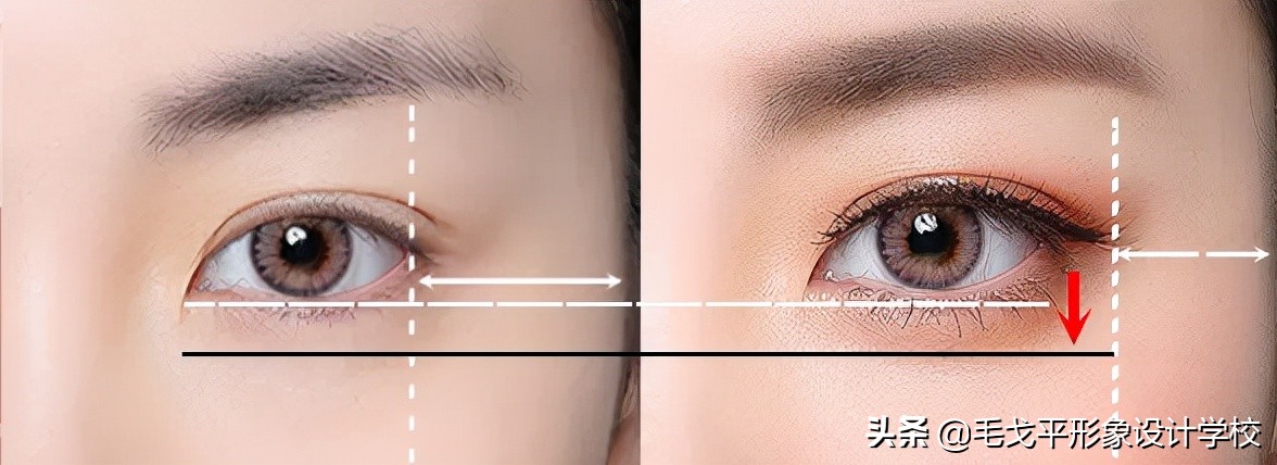 3步缩中庭摆脱老气变年轻,中庭过长的四个变美思路