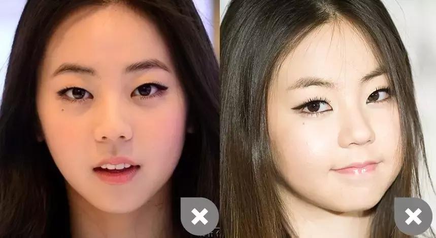 杨颖眼大,杨颖的眼睛瞪大了为什么好看