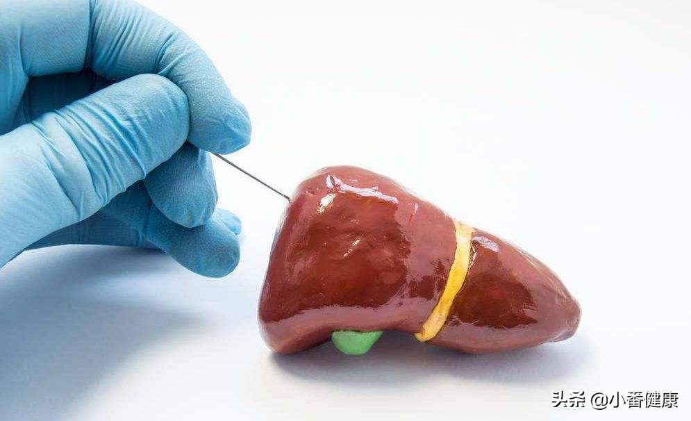 乙肝抗病毒治疗的药物的选择,乙肝基因b型适合哪种药物抗病毒