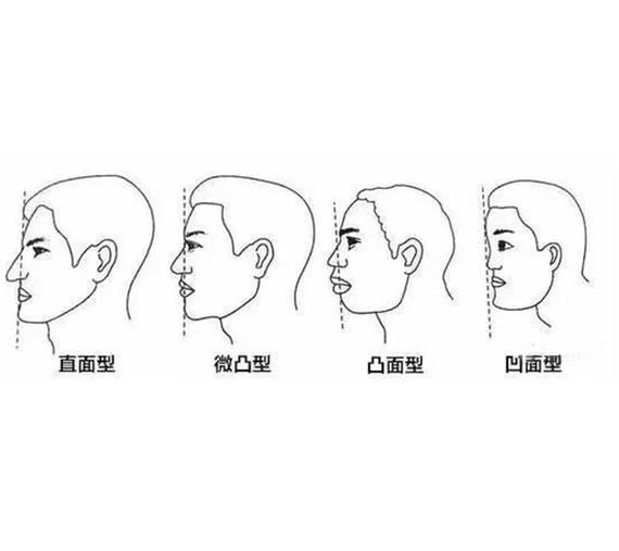怎么判断自己是嘴唇厚还是凸嘴,凸嘴的困扰