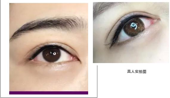 江南烟雾眉,烟雾眉多久才恢复自然状态