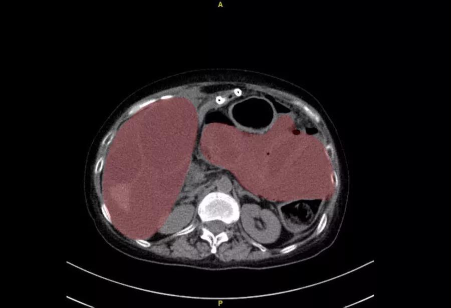 与死神赛跑医院上演生死营救2017,一场与死神争分夺秒的搏斗