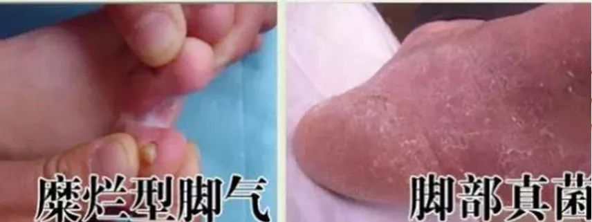 烘干机能去鞋臭,可以定时烘干鞋子神器杀菌除臭