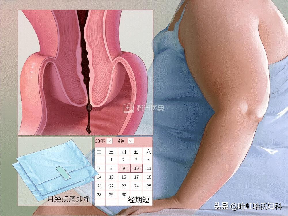 月经由7天变3天正常吗,月经由7天变成3天是什么原因