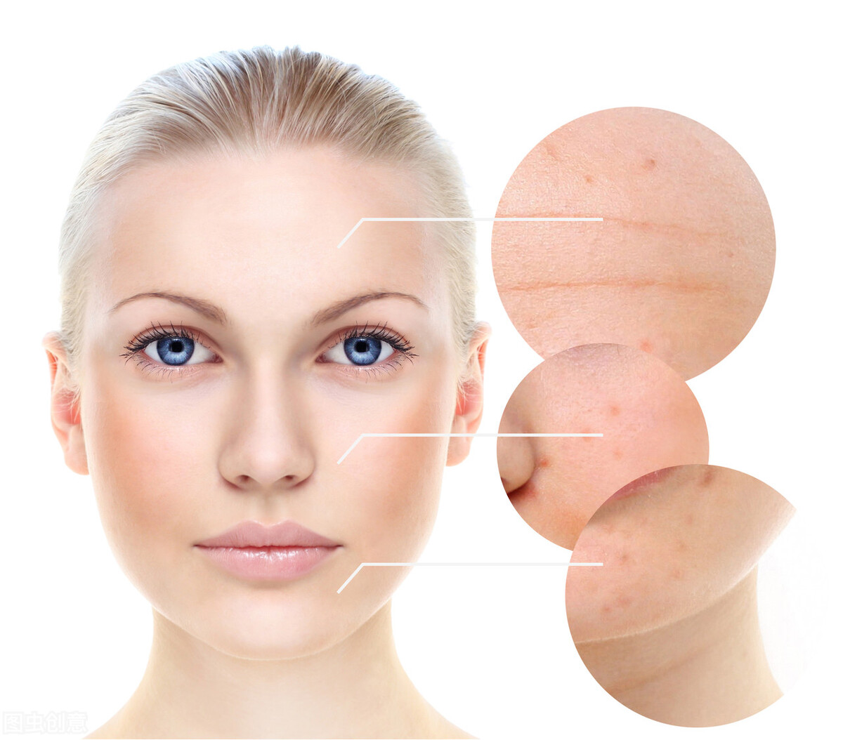 毛孔粗大有黑头怎么改善用什么药,毛孔粗大是什么原因应该怎样改善