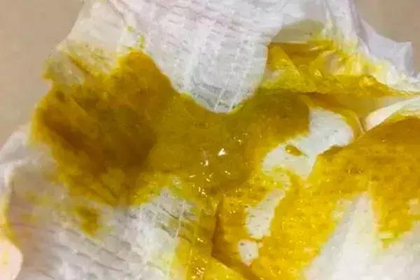 新手爸妈稳住！手把手教你看懂千姿百态大便便（超全观察指南）