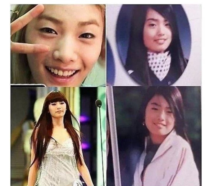 不用整形也可以变美吗,想变美做哪些手术