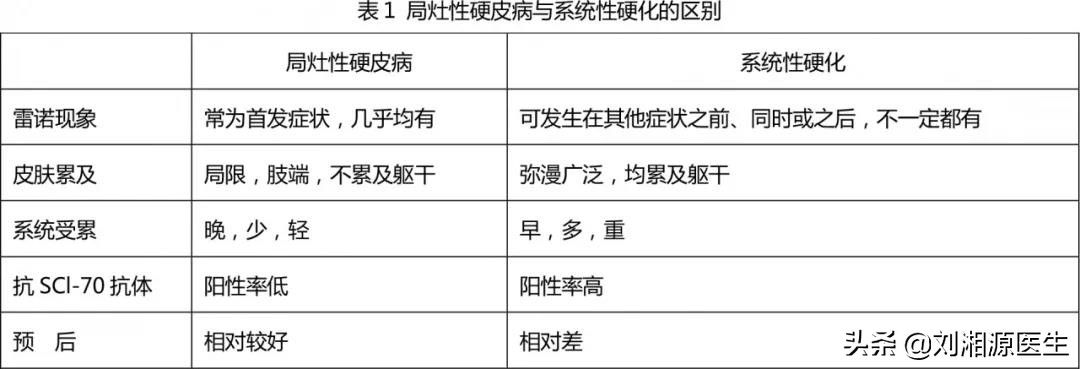 系统性硬化病患者可以怀孕吗,免疫相关不良妊娠诊断指南
