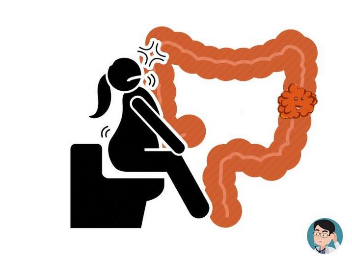 大便判断身体健康状况,怎么从大便颜色判断自己是否健康