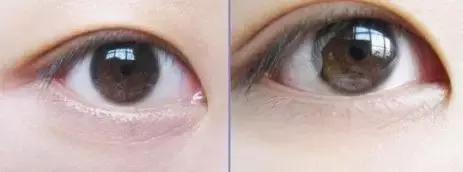 眼霜世界排行榜第一名,眼霜第一名抗皱眼油