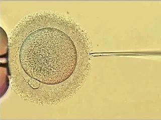 第一代第二代第三代试管婴儿,第一代第二代第三代试管婴儿费用