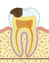 牙通肾，牙不好严重影响性功能！年轻人们长点心吧