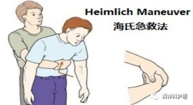 精神科噎食急救教学视频,精神科病人噎食后处理