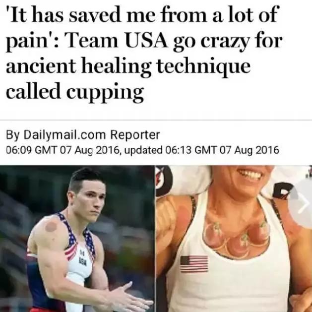 蚊帐成天价抢手货，拔罐变灵丹妙药，在外国人眼里，中国这么牛