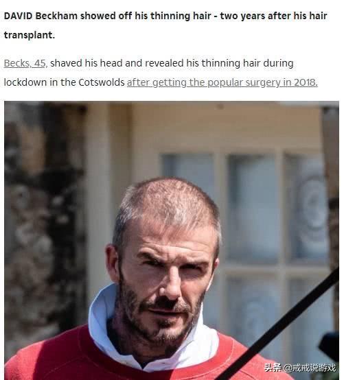为什么贝克汉姆光头还是帅,贝克汉姆光头帅照