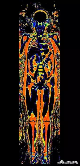 飞利浦磁共振快速扫描方案指南,飞利浦1.5t磁共振各部位扫描技术