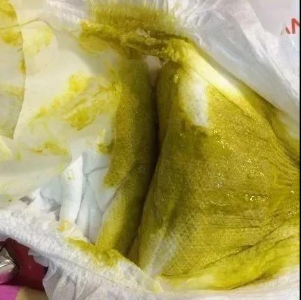幼儿腹泻粪便由黄色变绿色,一岁宝宝转奶完拉肚子