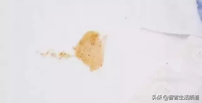 如何清洗白衣上霉斑,白衣服油渍怎么快速洗