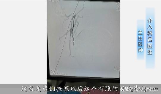 医生给你用图片讲解：前列腺增生如何微创治疗，一看就懂！