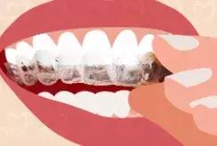 快看！这家店拯救了90%汕头人的牙齿烦恼