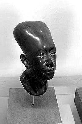 头骨有哪些有意思的特点,你的后脑勺是圆还是扁