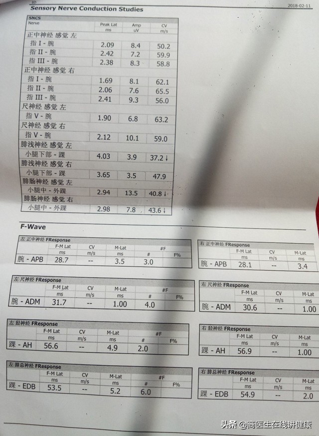 糖尿病神经病变吃甲钴胺能痊愈吗,糖尿病神经周围病变吃甲钴胺多久