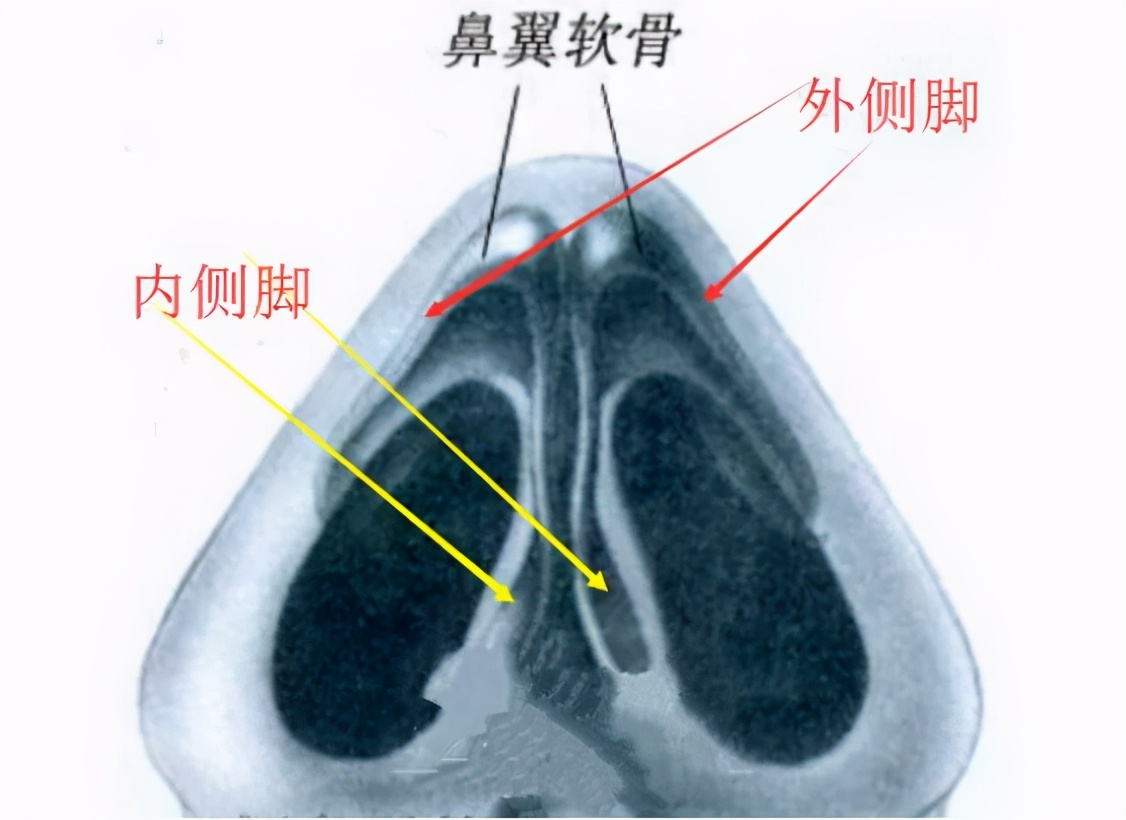 鼻头为什么会越捏越大,鼻头越缩越大是什么原因