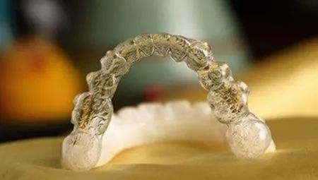 隐形牙套佩戴的注意事项,隐形牙套佩戴注意事项短视频