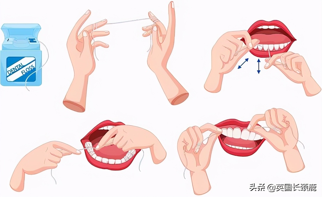 牙齿卫生用品,牙齿清洁工具排行榜