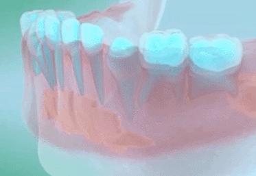 小孩乳牙没有掉要去医院拔牙,恒牙出来多久了乳牙未掉需要拔牙