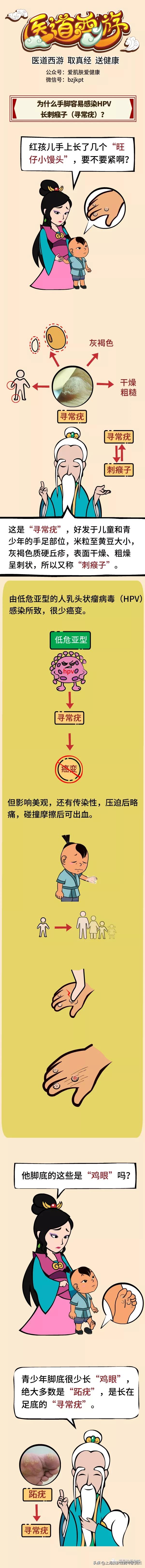 医道西游051-寻常疣：为啥你的手脚上容易感染HPV*刺长**瘊子？