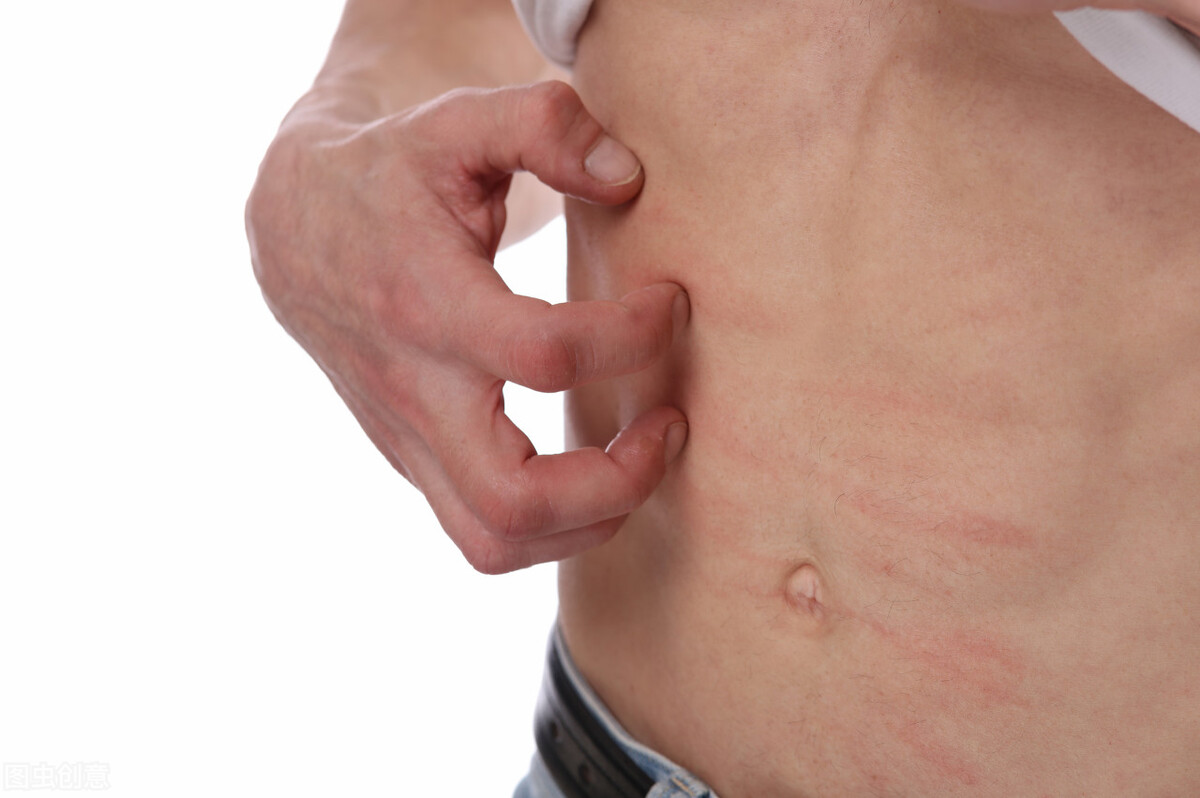 春季皮肤过敏发红发痒刺痛,换季皮肤过敏刺痛怎么办