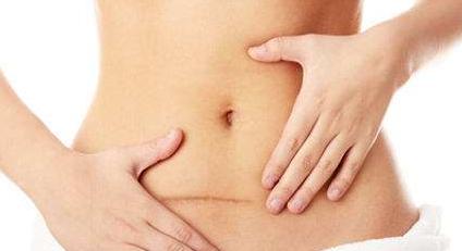 剖腹产不会导致松弛、漏尿、子宫脱垂？但这个危害很多女生不知道