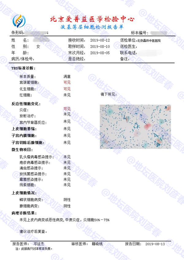 男性hpv16感染怎样治愈,感染hpv16能痊愈吗
