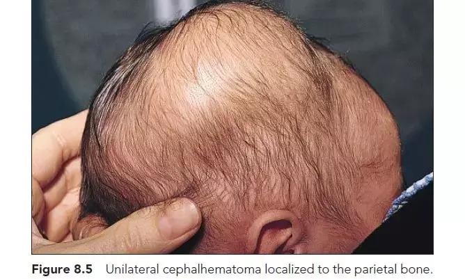 新生儿皮肤问题大全一览表,新生儿常见八大皮肤问题