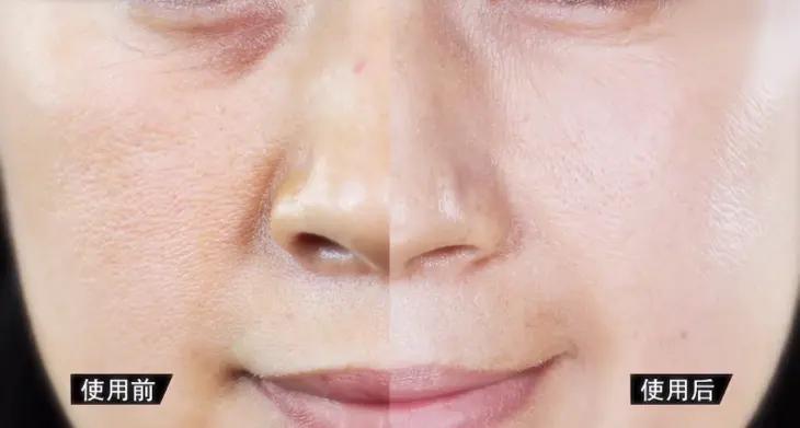 会拉丝的面膜,适合小脸的提拉面膜