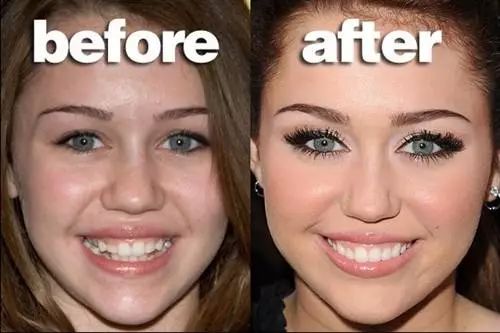 去除牙齿黄垢的神器,牙齿变白除口臭神器