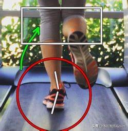 小儿足外翻康复训练弹力绷带,儿童足外翻康复训练教程