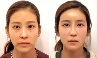 就因为这四个部位,别人像15而你像45