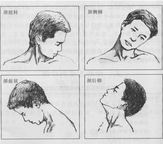 大夫告诉我痉挛性斜颈怎么治疗？