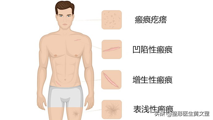 祛疤痕一站式修复,疤痕修复能完美吗