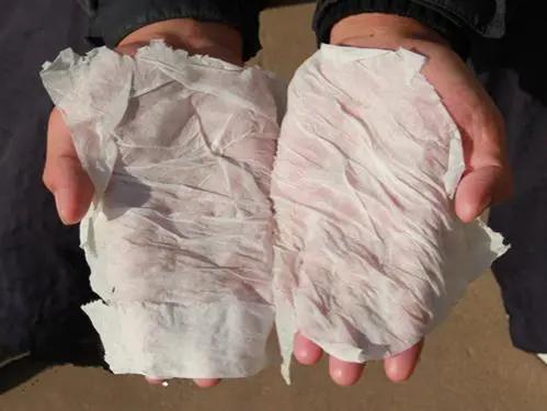 手汗症中医诊疗方案,手掌多汗症怎么治疗