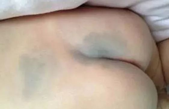 新生宝宝最常见的问题,新生宝宝必须注意的八件事