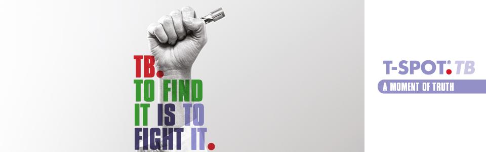 珀金埃尔默收购美国科学仪器,珀金埃尔默收购成功了吗