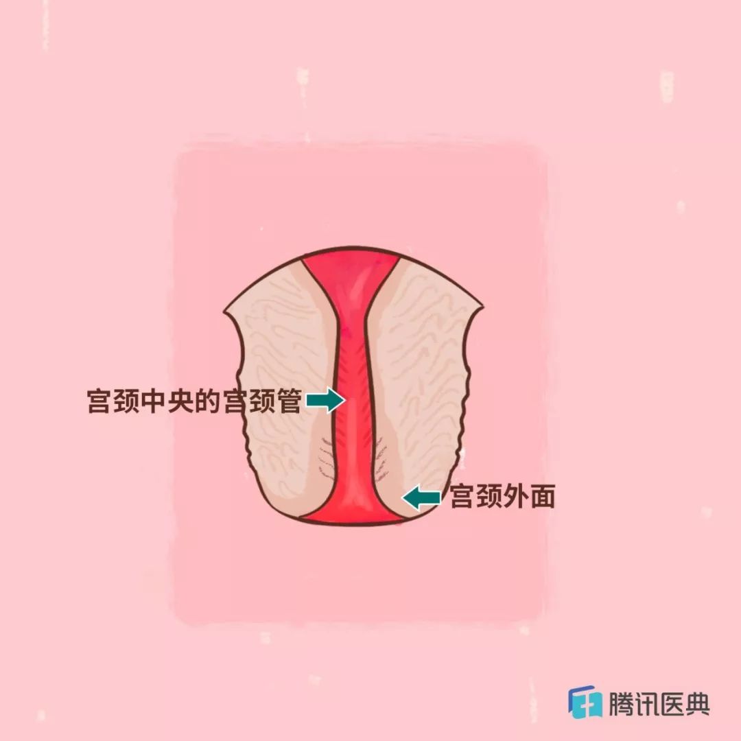 没错,这个所谓“妇科病”,应该改一下名字了