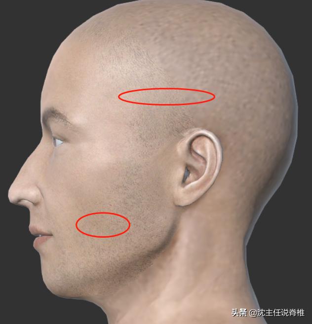 头部曾经受过伤现在头痛该怎么办,头部外伤十多年一直头痛怎么办