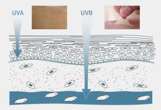 军训晒伤如何快速修复,军训中晒伤了怎么补救