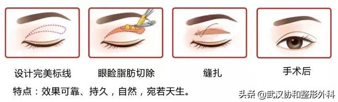 上海九院整形和协和整形,北京协和整形医院美容整形价格